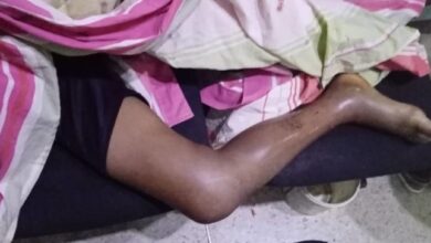 mordedura de serpiente