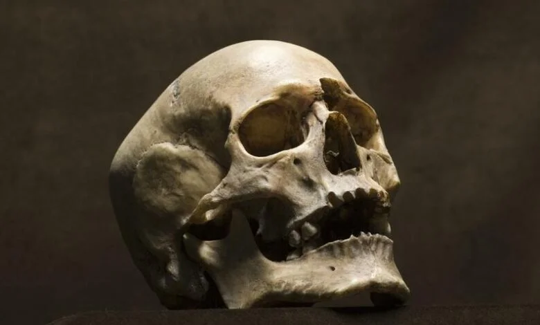 cráneo humano