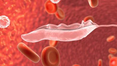 enfermedad del sueño