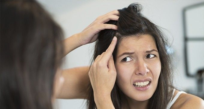Remedios caseros para eliminar la caspa