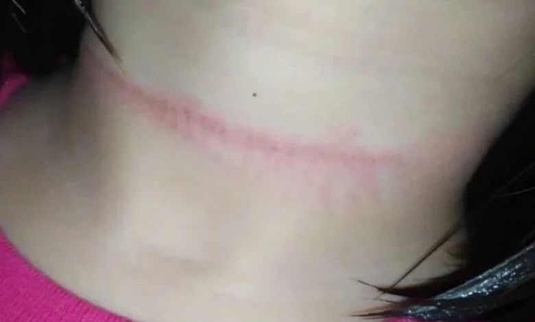 reto asfixia tiktok