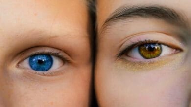 A la pregunta ‘¿En qué te fijas para juzgar el atractivo de una persona?’, son muchos los que responden que el color de los ojos es determinante. El color azul causa furor más que ningún otro, quizás por ser mucho menos frecuente que el marrón. Aunque, para raro y exclusivo, el color de la cautivadora mirada de la actriz Liz Taylor, de un tono violeta propio de la ciencia ficción. En nuestra vida cotidiana es frecuente preguntarnos por qué hijos de los mismos padres han heredado colores de ojos totalmente diferentes. ¿Acaso no sigue un patrón convencional de típica genética mendeliana? ¿Qué determina este carácter? ¿Por qué, por ejemplo, hay más del doble de mujeres con ojos verdes que hombres? El largo camino del color La mayoría de las poblaciones del mundo tienen ojos de diferentes tonos de marrón. Sin embargo, en gentes de origen europeo existe mayor diversidad. Además del marrón –el más común– hay otros colores prácticamente ausentes en poblaciones de otros continentes. Entre ellos azul, gris, verde o ámbar. Semejante variedad no puede existir por capricho. Si la evolución ha favorecido que existan diferentes tonos de iris debe ser por algo. Sin embargo, lo cierto es que tanto la función fisiológica del color del iris como sus posibles ventajas biológicas son un misterio. Con el color de la piel no hay tanto desconocimiento. Sabemos que este carácter está asociado con la intensidad de la radiación ultravioleta. Y que la evolución selecciona una piel más clara a medida que nos alejamos del Ecuador. Se debe a que es necesario que exista un equilibrio entre la protección de la piel frente a la radiación ultravioleta y la producción de vitamina D que es estimulada por los rayos del sol. Una piel excesivamente pigmentada en latitudes muy al norte (o al sur) daría lugar a una deficiencia de esta vitamina y problemas de salud, especialmente en la formación de los huesos. Pero nada de esto parece guardar relación directa con el color de los ojos. Lo que sí sabemos es que el color del iris depende de 3 parámetros fundamentales: El tipo de pigmento, eumelanina para el marrón oscuro-negro y feomelanina de color rojizo; la cantidad y distribución de melanosomas, es decir, de los pequeños sacos cargados de pigmento dentro de las células del epitelio; las variaciones en la estructura fina del iris, las encantadoras contracciones y los misteriosos nudos que podemos observar especialmente en personas de ojos claros. ¿Y qué hay de los genes? En 2007 se realizó el primer estudio de genoma completo en poblaciones europeas identificándose 10 genes implicados en este carácter. Este estudio fue posteriormente replicado y los genes confirmados por otro equipo de investigadores. Esto permitió desarrollar un sistema de predicción del color de los ojos en función de datos genéticos, el denominado Hirisplex. Sin embargo, no era un sistema de predicción totalmente fiable. Funcionaba muy bien para discriminar entre ojos marrones y azules, pero para el resto de los colores era relativamente ineficiente. ¿Por qué? Pues porque se habían quedado cortos. Lo demuestra un estudio publicado este mismo año y basado en el mayor número de voluntarios reclutados hasta la fecha, casi 200.000. Los autores identificaron un total de 52 genes diferentes que influyen en el color de los ojos. ¡Más de medio centenar! Parece claro que estamos ante un carácter biológico complejo donde los haya. Esto no se parece nada a la herencia de los grupos sanguíneos ni al color de las flores de los guisantes de Mendel que nos enseñaban en el instituto. Genética de caracteres complejos Es solo un ejemplo de lo que nos depara la llamada genética de caracteres complejos. Una de las grandes beneficiadas será la ciencia forense, dado que pronto podremos predecir a partir de una gota de sangre o de un trozo de hueso, no solo el color de la piel y los ojos, sino también otros caracteres morfológicos más complejos. Sin ir más lejos, un estudio español reciente permitió conocer el aspecto de los cazadores del paleolítico. Eran negros de piel y con ojos azules, un fenotipo ausente en las poblaciones europeas actuales y absolutamente inesperado.