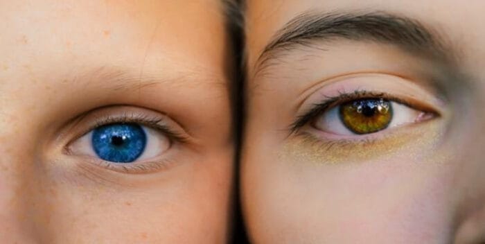 A la pregunta ‘¿En qué te fijas para juzgar el atractivo de una persona?’, son muchos los que responden que el color de los ojos es determinante. El color azul causa furor más que ningún otro, quizás por ser mucho menos frecuente que el marrón. Aunque, para raro y exclusivo, el color de la cautivadora mirada de la actriz Liz Taylor, de un tono violeta propio de la ciencia ficción. En nuestra vida cotidiana es frecuente preguntarnos por qué hijos de los mismos padres han heredado colores de ojos totalmente diferentes. ¿Acaso no sigue un patrón convencional de típica genética mendeliana? ¿Qué determina este carácter? ¿Por qué, por ejemplo, hay más del doble de mujeres con ojos verdes que hombres? El largo camino del color La mayoría de las poblaciones del mundo tienen ojos de diferentes tonos de marrón. Sin embargo, en gentes de origen europeo existe mayor diversidad. Además del marrón –el más común– hay otros colores prácticamente ausentes en poblaciones de otros continentes. Entre ellos azul, gris, verde o ámbar. Semejante variedad no puede existir por capricho. Si la evolución ha favorecido que existan diferentes tonos de iris debe ser por algo. Sin embargo, lo cierto es que tanto la función fisiológica del color del iris como sus posibles ventajas biológicas son un misterio. Con el color de la piel no hay tanto desconocimiento. Sabemos que este carácter está asociado con la intensidad de la radiación ultravioleta. Y que la evolución selecciona una piel más clara a medida que nos alejamos del Ecuador. Se debe a que es necesario que exista un equilibrio entre la protección de la piel frente a la radiación ultravioleta y la producción de vitamina D que es estimulada por los rayos del sol. Una piel excesivamente pigmentada en latitudes muy al norte (o al sur) daría lugar a una deficiencia de esta vitamina y problemas de salud, especialmente en la formación de los huesos. Pero nada de esto parece guardar relación directa con el color de los ojos. Lo que sí sabemos es que el color del iris depende de 3 parámetros fundamentales: El tipo de pigmento, eumelanina para el marrón oscuro-negro y feomelanina de color rojizo; la cantidad y distribución de melanosomas, es decir, de los pequeños sacos cargados de pigmento dentro de las células del epitelio; las variaciones en la estructura fina del iris, las encantadoras contracciones y los misteriosos nudos que podemos observar especialmente en personas de ojos claros. ¿Y qué hay de los genes? En 2007 se realizó el primer estudio de genoma completo en poblaciones europeas identificándose 10 genes implicados en este carácter. Este estudio fue posteriormente replicado y los genes confirmados por otro equipo de investigadores. Esto permitió desarrollar un sistema de predicción del color de los ojos en función de datos genéticos, el denominado Hirisplex. Sin embargo, no era un sistema de predicción totalmente fiable. Funcionaba muy bien para discriminar entre ojos marrones y azules, pero para el resto de los colores era relativamente ineficiente. ¿Por qué? Pues porque se habían quedado cortos. Lo demuestra un estudio publicado este mismo año y basado en el mayor número de voluntarios reclutados hasta la fecha, casi 200.000. Los autores identificaron un total de 52 genes diferentes que influyen en el color de los ojos. ¡Más de medio centenar! Parece claro que estamos ante un carácter biológico complejo donde los haya. Esto no se parece nada a la herencia de los grupos sanguíneos ni al color de las flores de los guisantes de Mendel que nos enseñaban en el instituto. Genética de caracteres complejos Es solo un ejemplo de lo que nos depara la llamada genética de caracteres complejos. Una de las grandes beneficiadas será la ciencia forense, dado que pronto podremos predecir a partir de una gota de sangre o de un trozo de hueso, no solo el color de la piel y los ojos, sino también otros caracteres morfológicos más complejos. Sin ir más lejos, un estudio español reciente permitió conocer el aspecto de los cazadores del paleolítico. Eran negros de piel y con ojos azules, un fenotipo ausente en las poblaciones europeas actuales y absolutamente inesperado.