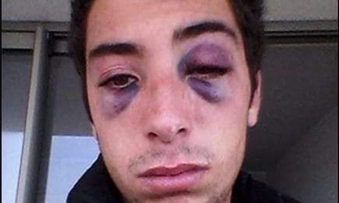 golpeado