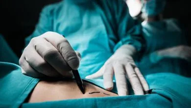operacion