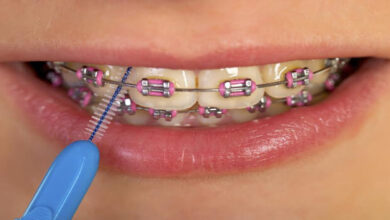 brackets
