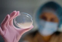 Investigadores iraníes desarrollan un hidrogel fotosensible para tratar el cáncer de mama